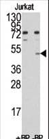 MINA / MINA53 Antibody (aa397-429)