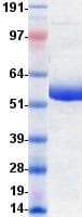 Human CD72 Protein (Recombinant Fc, C-terminus)