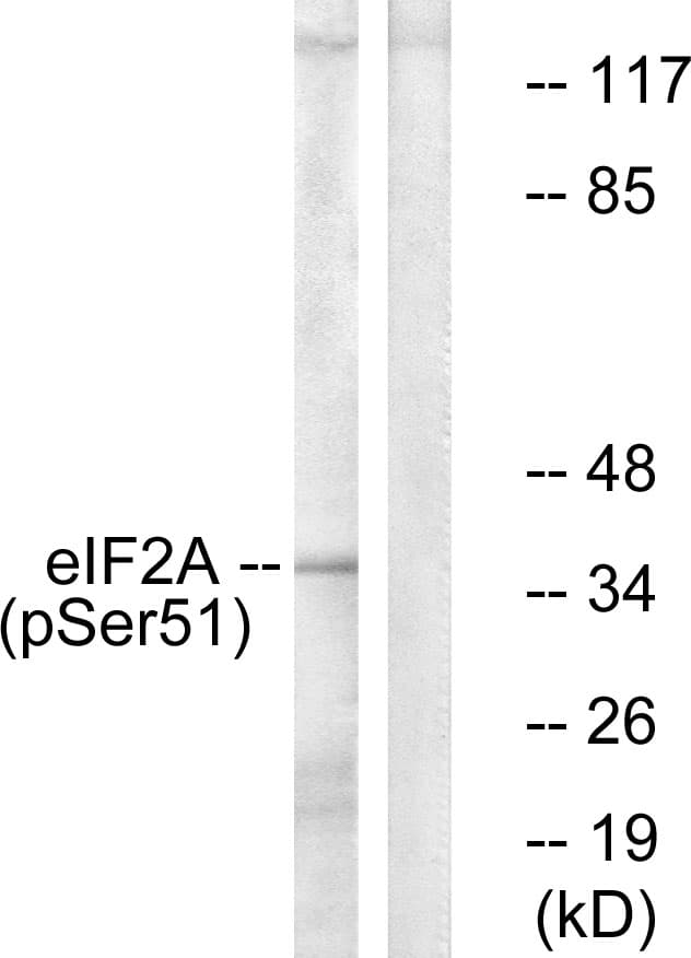Polyclonal Rabbit anti-Human EIF2S1 Antibody (phospho-Ser51, WB)