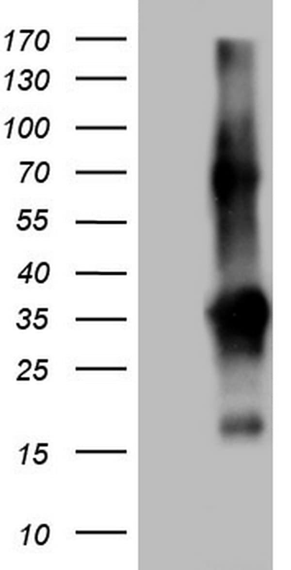 TACC2 Antibody (aa727-1026, clone OTI3C4)
