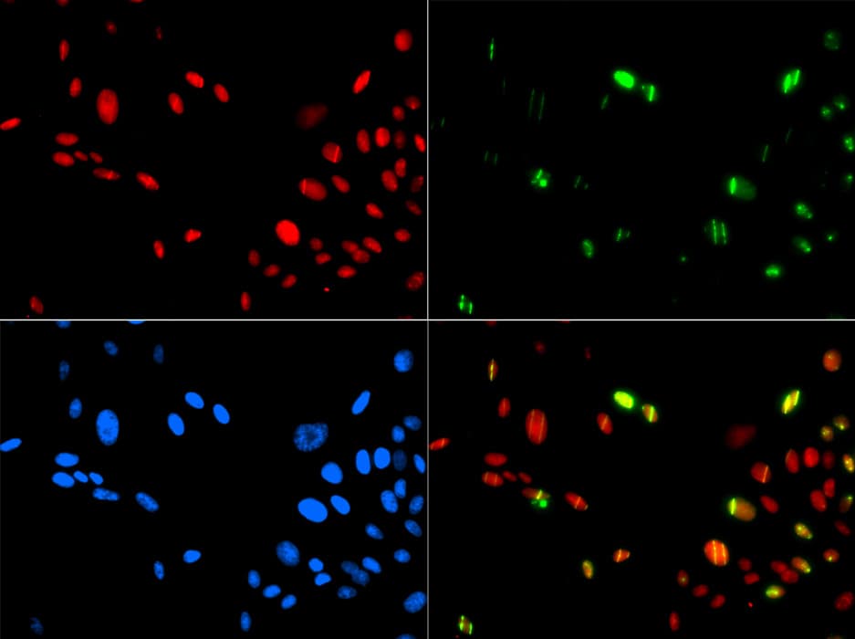 HMG1 / HMGB1 Antibody