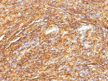 ANO1 / DOG1 / TMEM16A Antibody (clone DG1/1484)