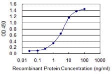 TG / Thyroglobulin Antibody (clone 1G3)