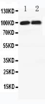 DLG4 / PSD95 Antibody (aa492-507)