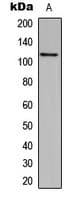 Polyclonal Rabbit anti-Human CCP110 Antibody (C-Terminus, IHC, WB)