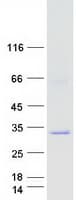 Human NAT15 Protein (Recombinant Myc-DDK (Flag))