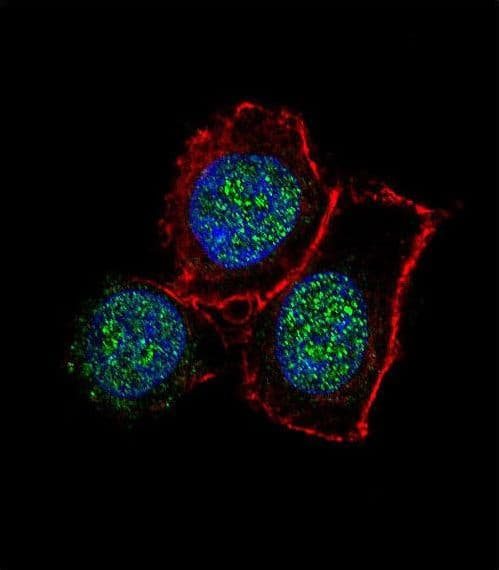 KDM6B / JMJD3 Antibody (aa1-30)