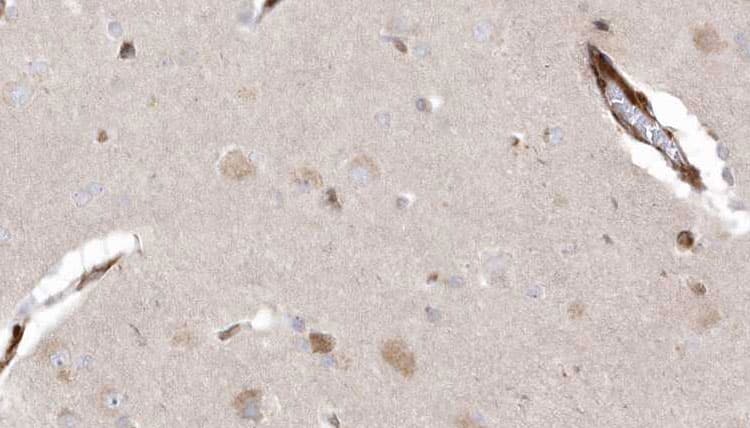 Polyclonal Rabbit anti-Human CYLD Antibody (IHC, WB)