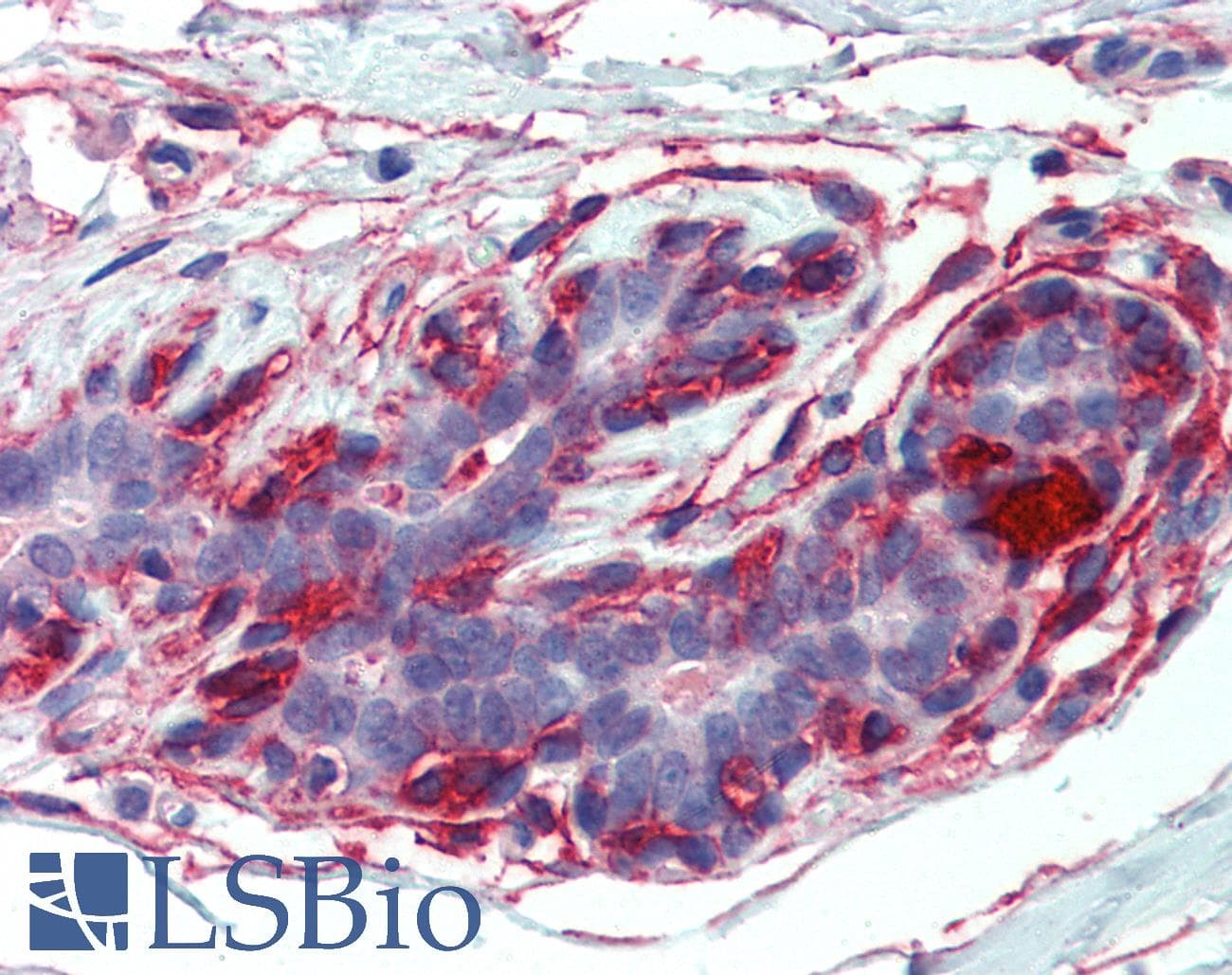 IHC-plus™ EPB41L2 Antibody (aa347-357)