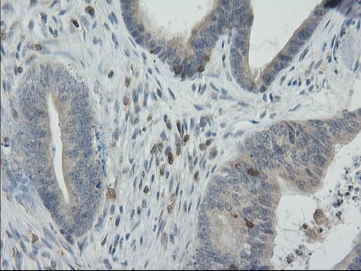 GPR49 / LGR5 Antibody (aa250-550, clone OTI2A2)