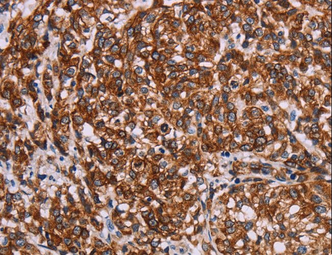 KRT14 / CK14 / Cytokeratin 14 Antibody