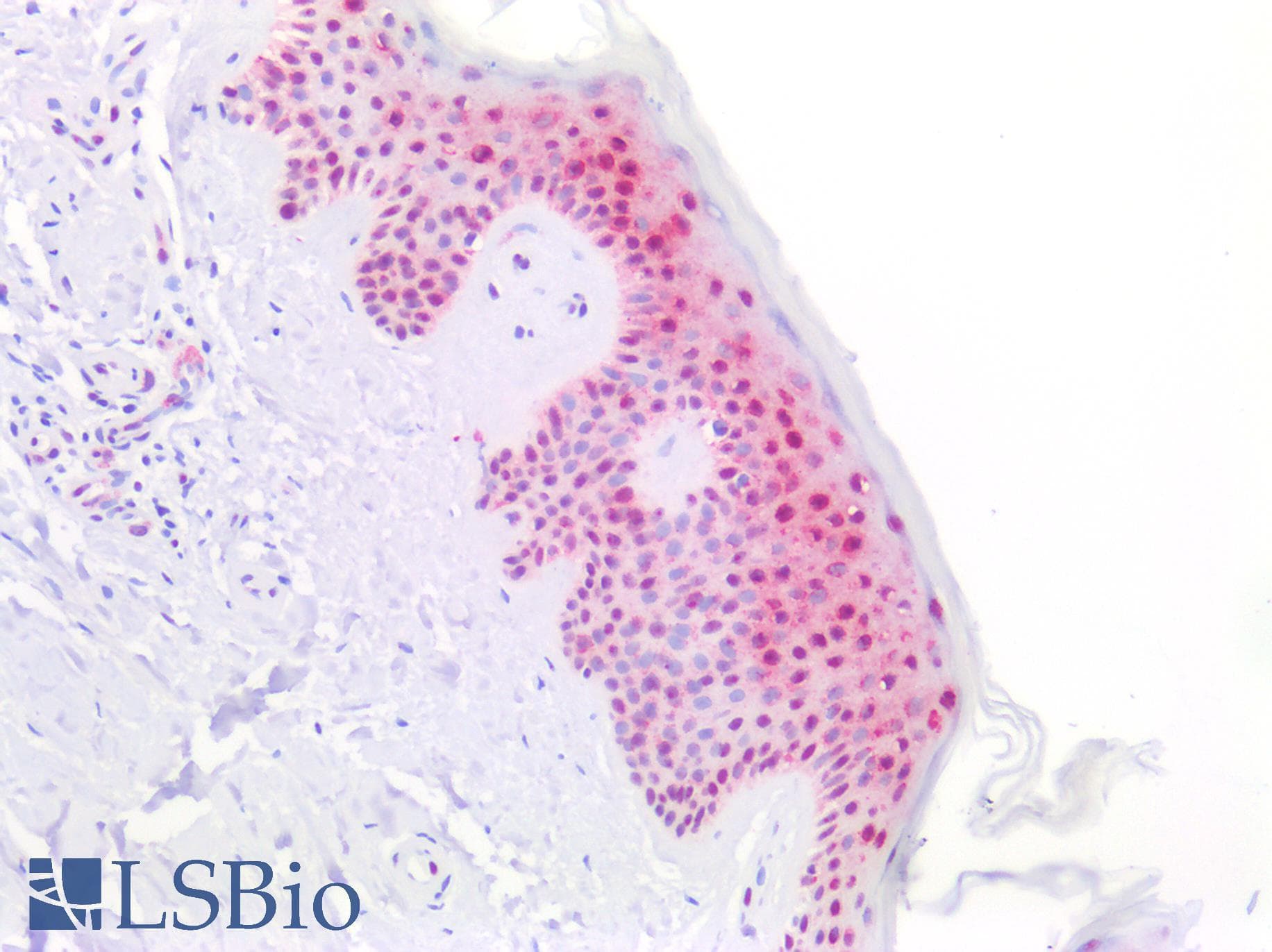 PathPlus™ SMN1 Antibody (aa50-100)