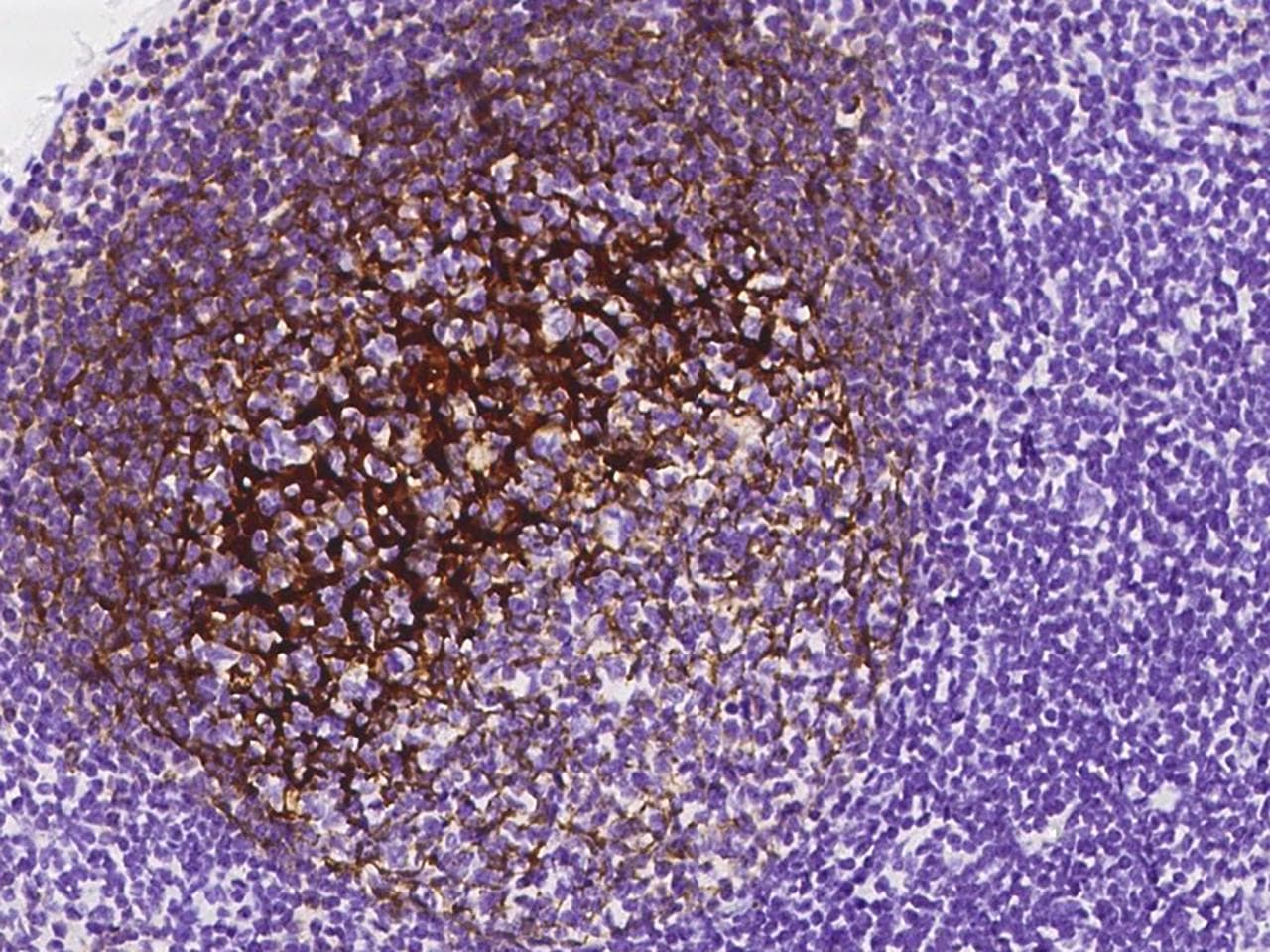 Monoclonal Mouse anti-Human CR2 / CD21 Antibody (clone 28, Preservative Free, IHC)