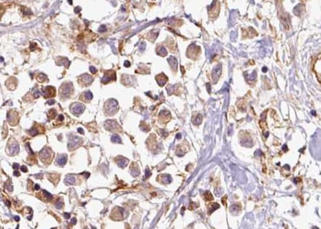 Polyclonal Rabbit anti-Human BRCA1 Antibody (phospho-Ser1423, IHC, WB)