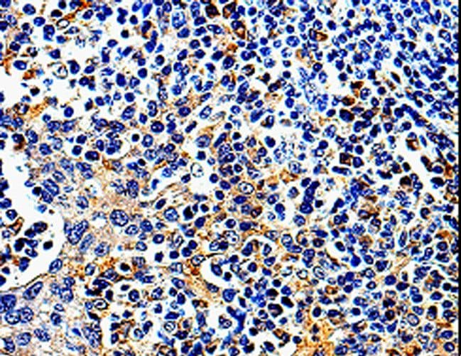 COX16 / C14orf112 Antibody