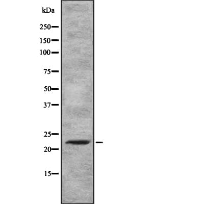 Polyclonal Rabbit anti-Human MXD3 / MAD3 Antibody (WB)