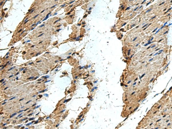 ERLIN1 / SPFH1 Antibody