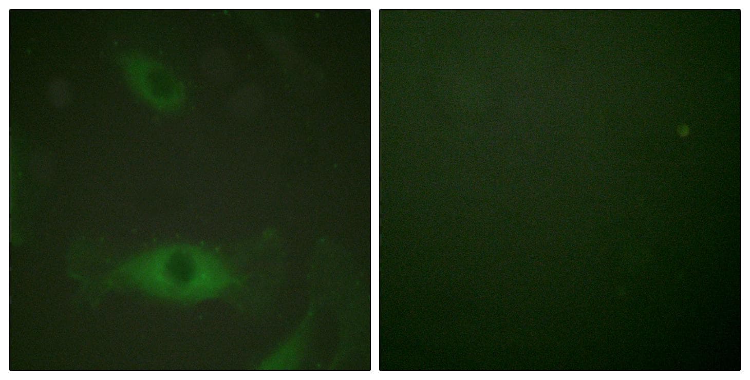 PLA2G4A Antibody (phospho-Ser505)