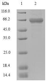 Human DHX9 Protein (Recombinant 6His-DDK (Flag), N-terminus)