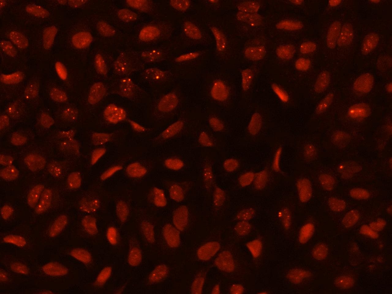 TP53BP1 / 53BP1 Antibody