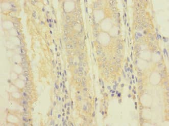 Polyclonal Rabbit anti-Human ITGB7 / Integrin Beta 7 Antibody (IHC)