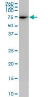 PLS1 / Fimbrin Antibody (clone 3G10)