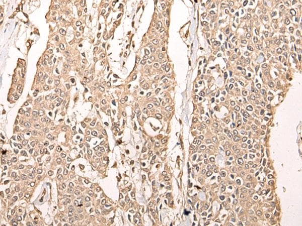 ATAD3A Antibody