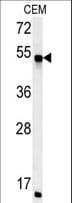 FKBP38 / FKBP8 Antibody (aa199-226)