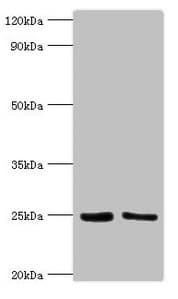 M. tuberculosis MPT64 Antibody
