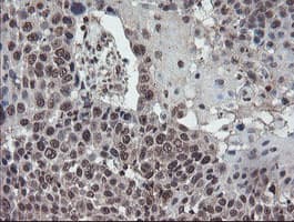 TDO2 Antibody (clone OTI2A4)