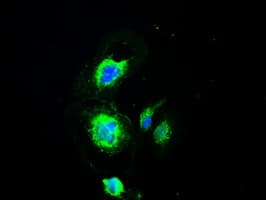 Monoclonal Mouse anti-Human PMEL / SILV / gp100 Antibody (clone OTI10E5, IHC, IF, WB)