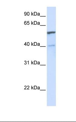 UGT1A6 Antibody (C-Terminus)