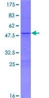 Human SRY Protein (Recombinant GST)