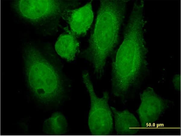 RAB3A Antibody (clone 4H7)