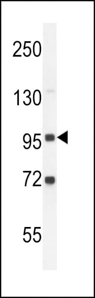 GPLD1 / GPIPLD Antibody (aa679-709)