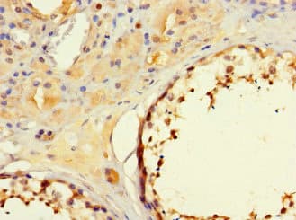 MORC1 Antibody