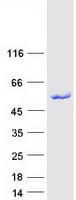 Human TRIT1 Protein (Recombinant Myc-DDK (Flag))