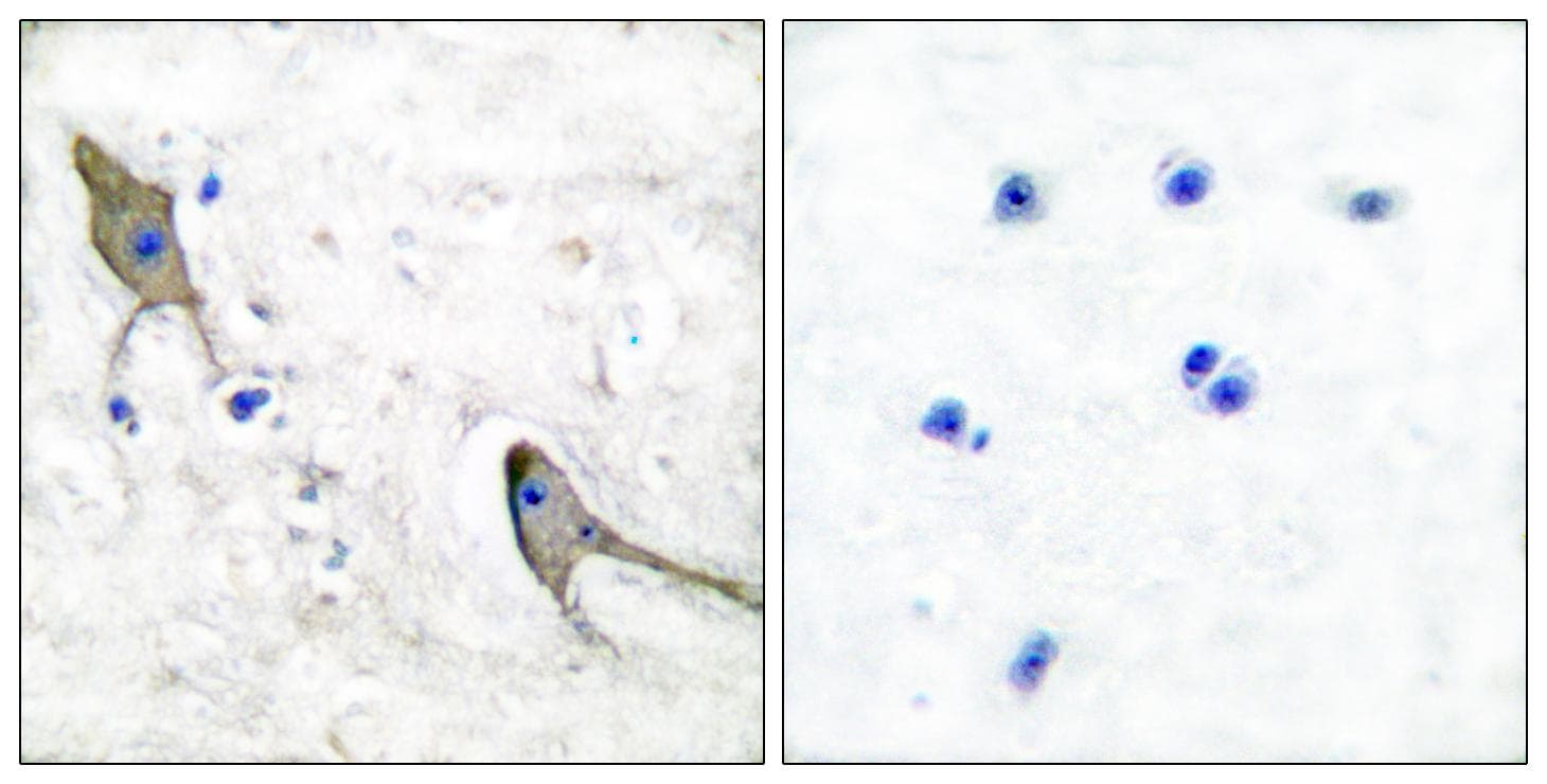 PTK2B / PYK2 Antibody (p881)