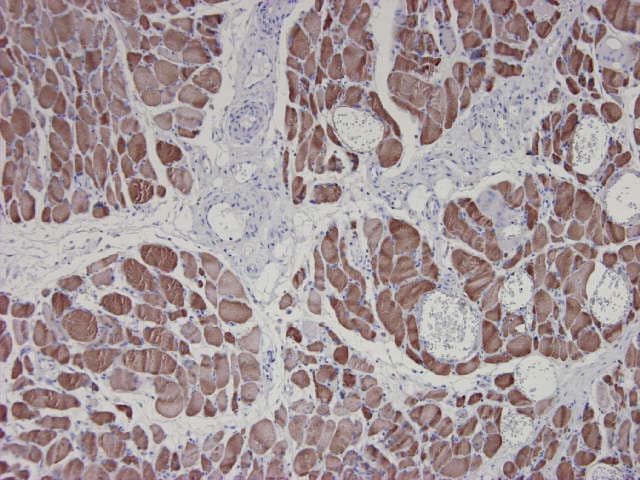 IHC-plus™ ACTA1 / Skeletal Muscle Actin Antibody (clone 3B3)