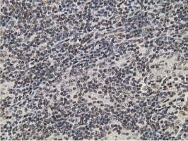 Monoclonal Mouse anti-Human 15-PGDH / HPGD Antibody (clone OTI1E9, IHC, WB)