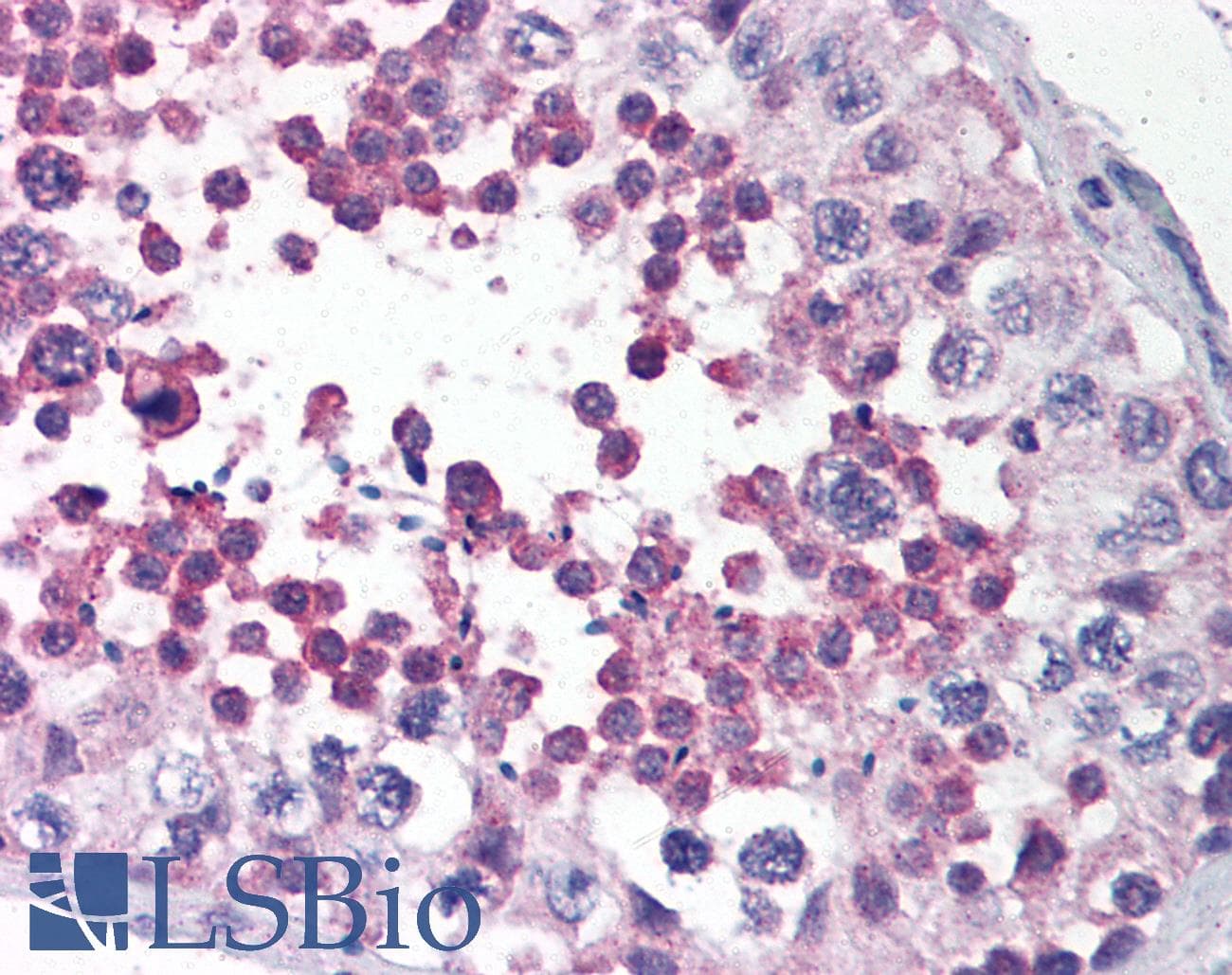IHC-plus™ LANO / LRRC1 Antibody