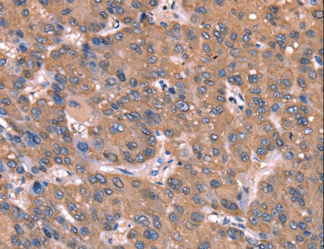 GCET2 / HGAL Antibody