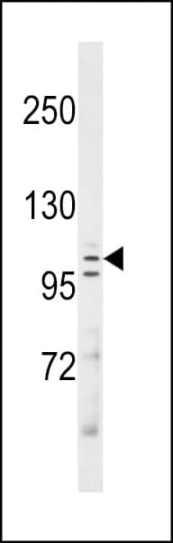 MAN2C1 Antibody (aa113-142)