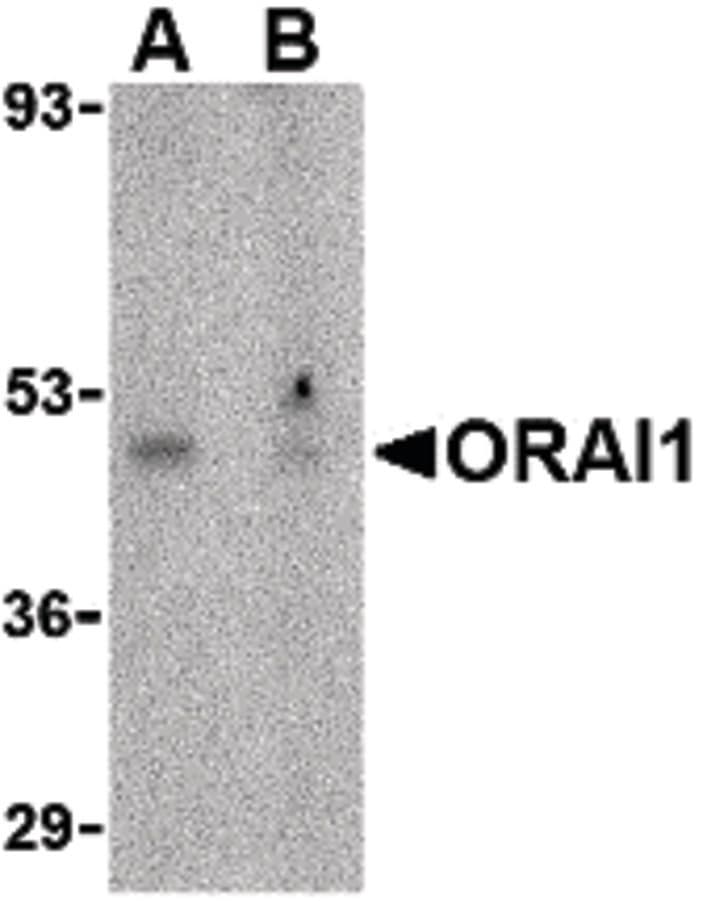 Polyclonal Rabbit anti-Human TMEM142A / ORAI1 Antibody (IHC, IF, WB)