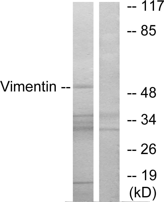 Vimentin Antibody (aa56-105)