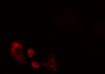 CES2 / Esterase Antibody