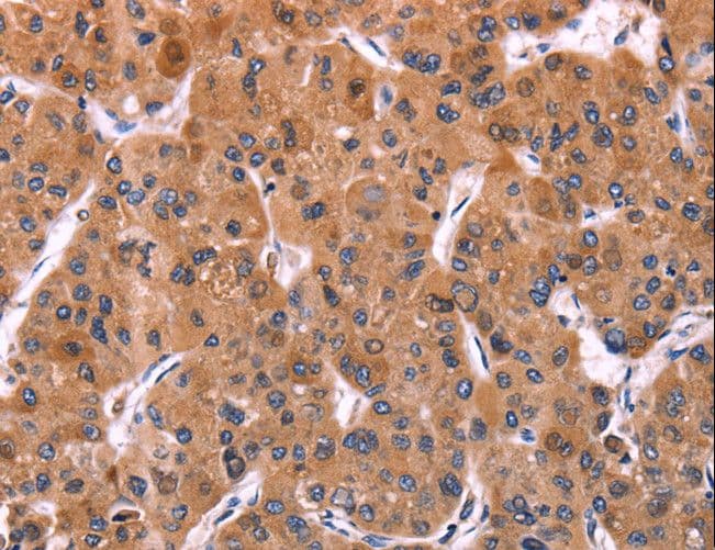 ERP29 Antibody