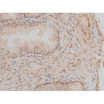 CREB1 / CREB Antibody (phospho-Ser142)