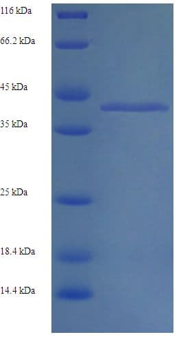 Rabbit ALDOB Protein (Recombinant His)