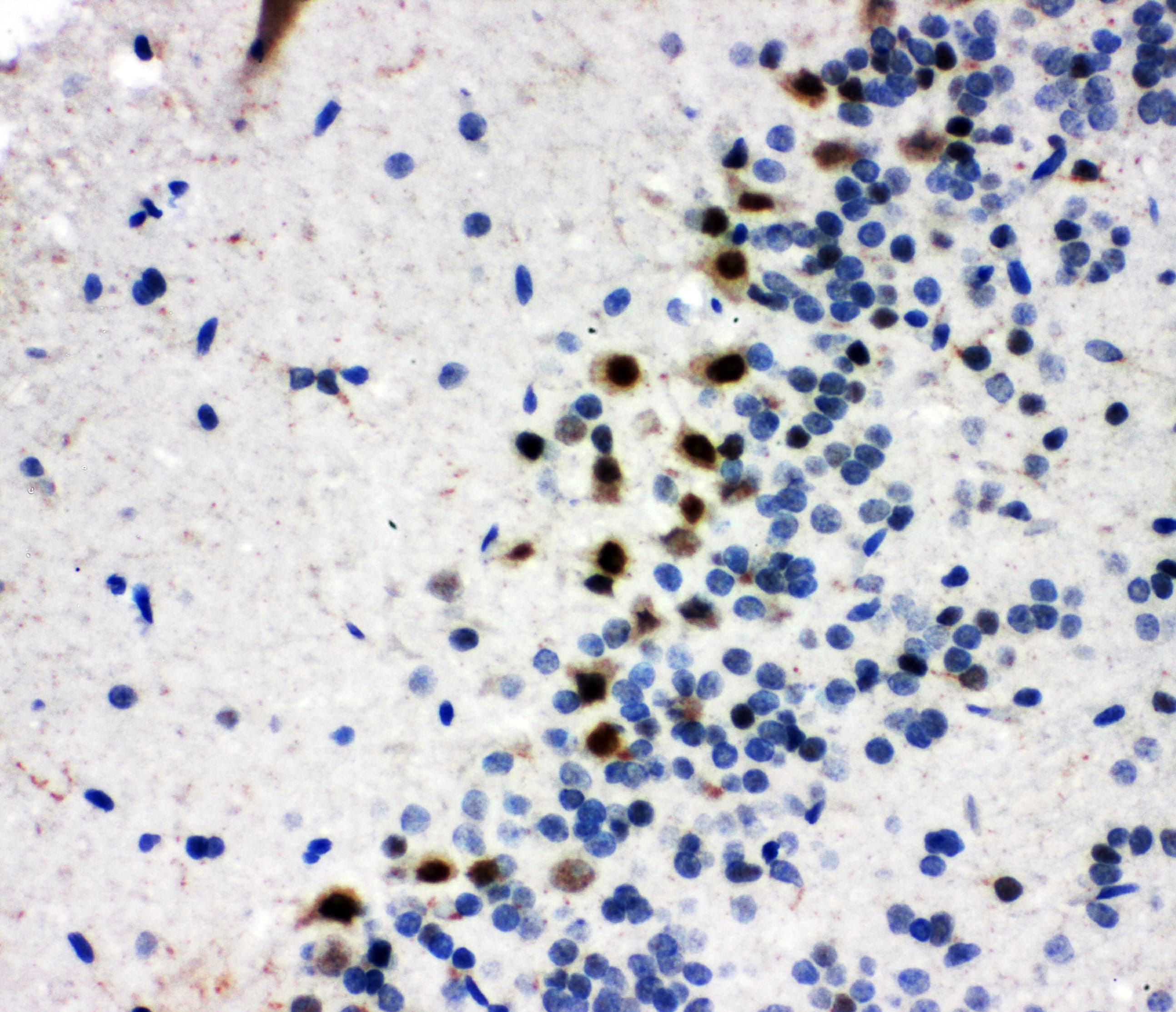 MYBL2 Antibody (aa1-17)